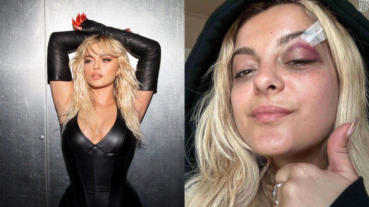 Agressor de Bebe Rexha pode ter acusações retiradas após cumprir serviço comunitário agressor-de-bebe-rexha-pode-ter-acusacoes-retiradas-apos-cumprir-servico-comunitario